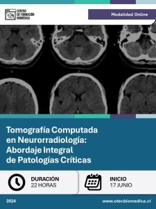 [BROCHURE] TC en Neurorradiología