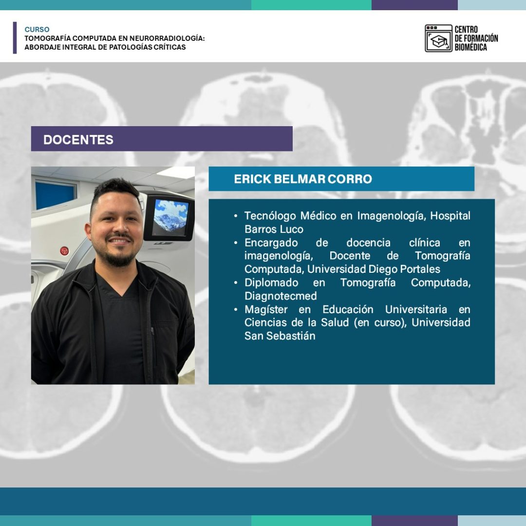 Tomografía Computada en Neurorradiología:  Abordaje Integral de Patologías Críticas - Imagen 5