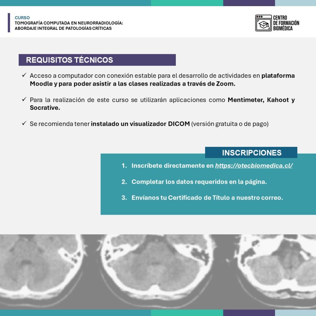 Tomografía Computada en Neurorradiología:  Abordaje Integral de Patologías Críticas - Imagen 7