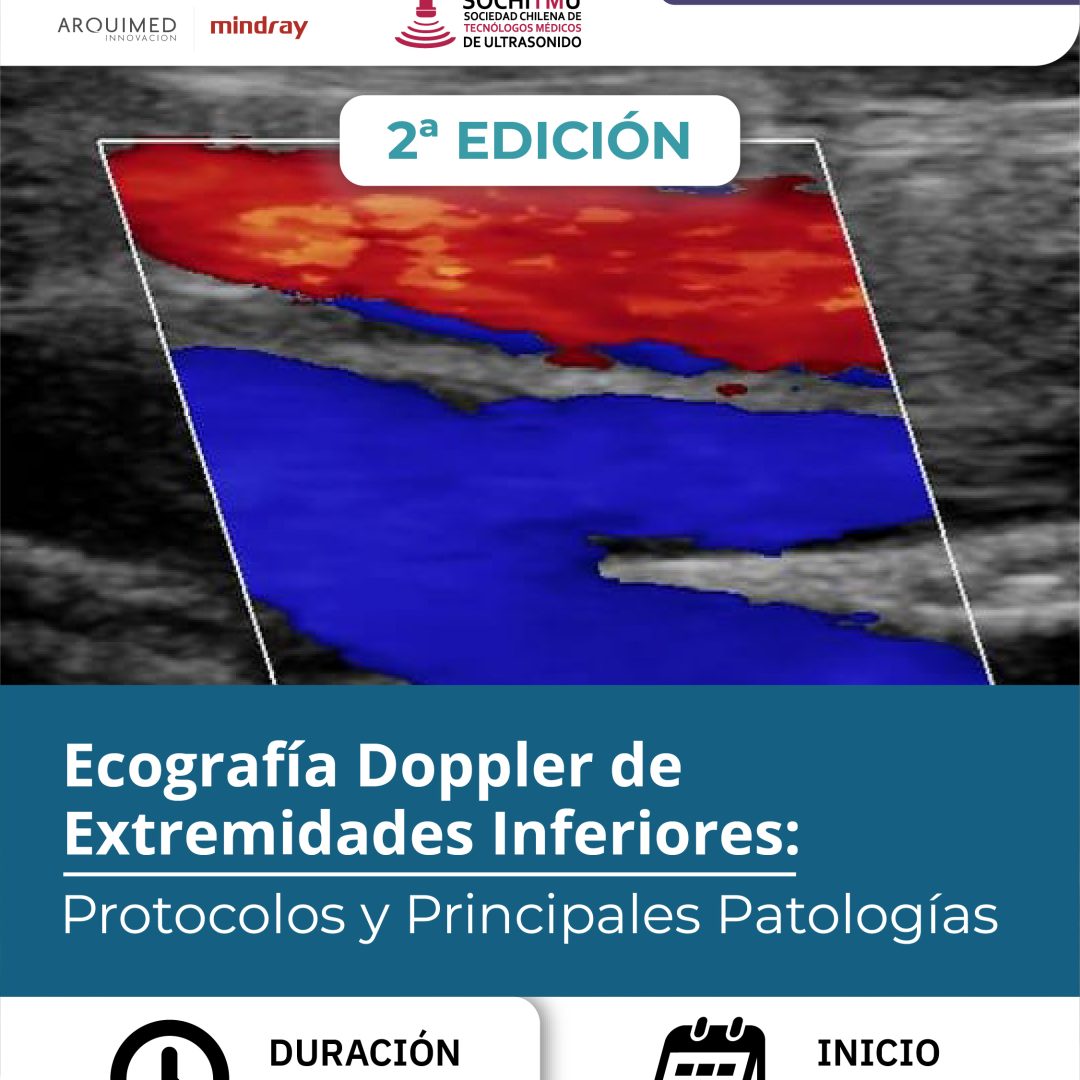[Online/SOCHITMU] Ecografía Doppler de Extremidades Inferiores: Protocolos y Principales Patologías