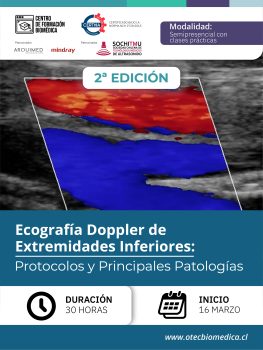 [Online/SOCHITMU] Ecografía Doppler de Extremidades Inferiores: Protocolos y Principales Patologías