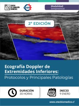 [Semipresencial/SOCHITMU] Ecografía Doppler de Extremidades Inferiores: Protocolos y Principales Patologías