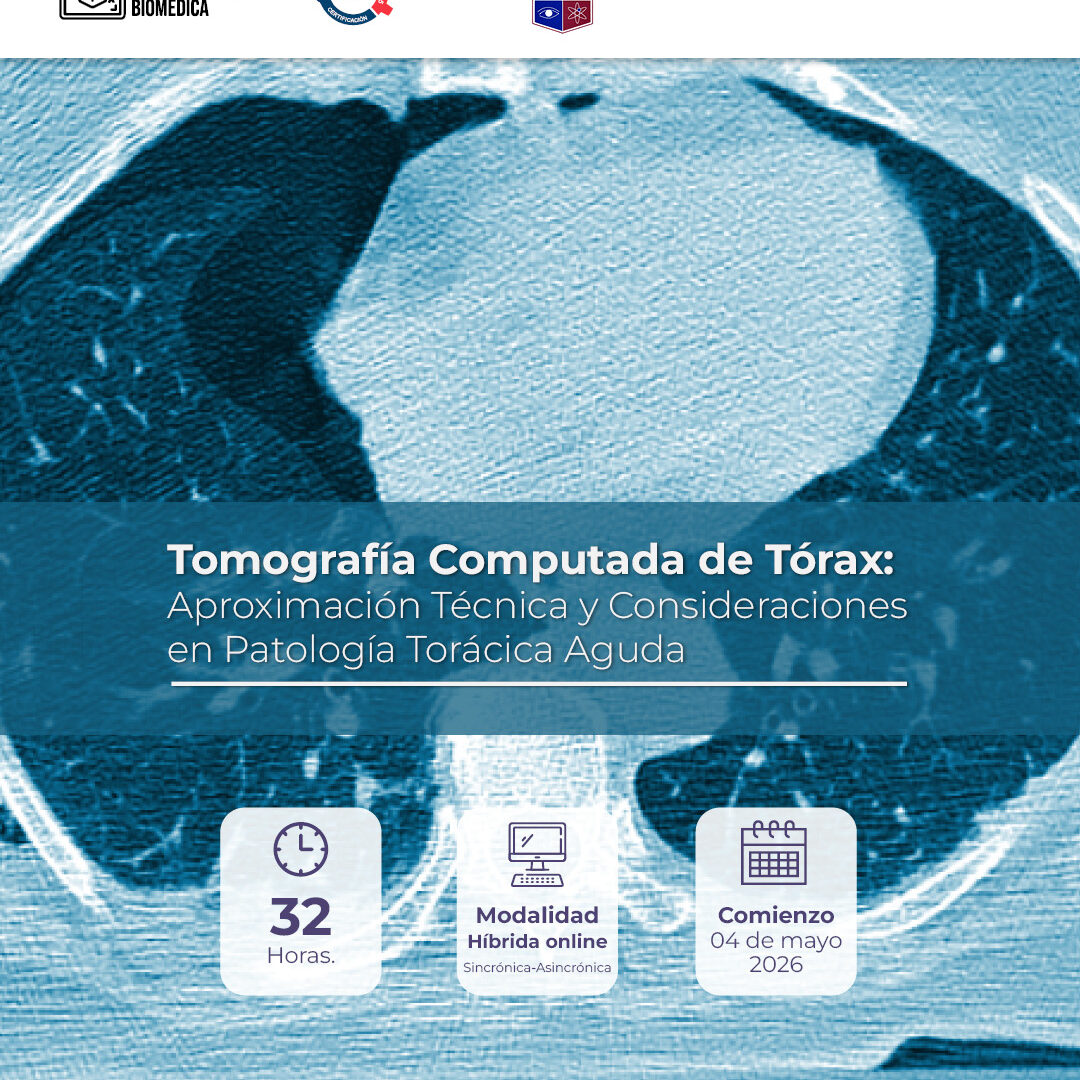Tomografía Computada de Tórax: Aproximación Técnica y consideraciones en Patología Torácica Aguda